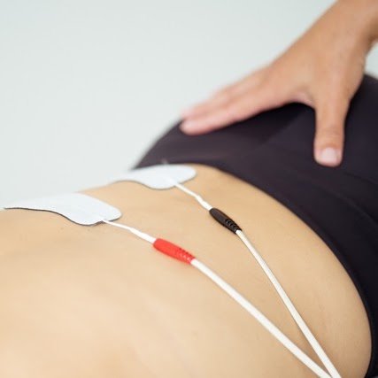 Neuroraumeninė elektrostimuliacija